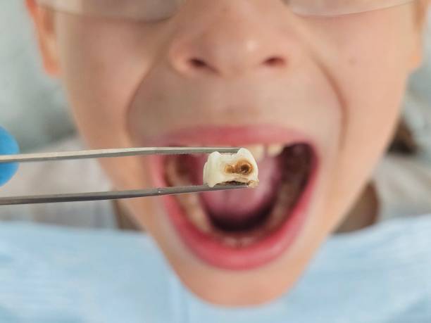 Best Pediatric Emergency Dentist in Port Norris, NJ