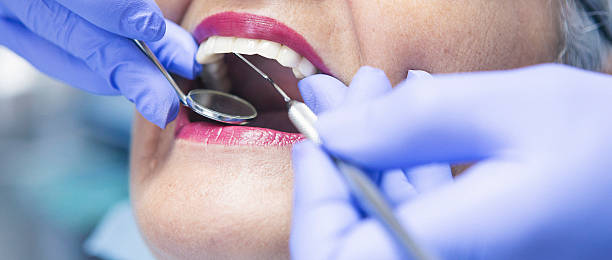 Best Emergency Root Canal Treatment in Port Norris, NJ